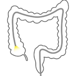 Colonoscopias
