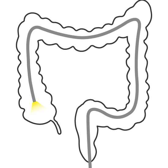 Colonoscopia